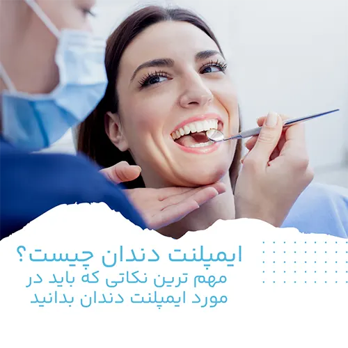 ایمپلنت دندان چیست؟ مهم ترین نکاتی که باید در مورد ایمپلنت دندان بدانید